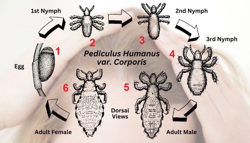 Breaking The Head Lice Life Cycle Infestation For A Family Of Five